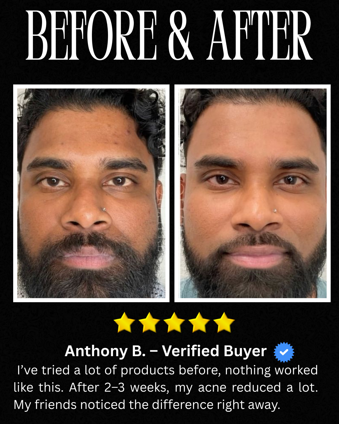 Vitamin C Face Serum